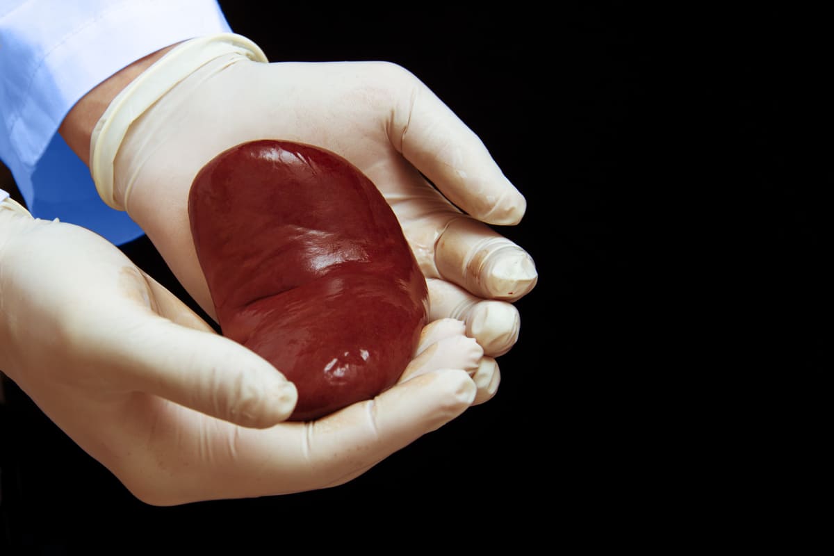 transplante-renal